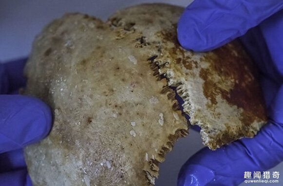 古希臘驚現全球最老電腦 2000年前的人骨