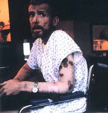 1990年2月13日世界衛生組織宣布每年12月1日為“世界愛滋病日”_歷史上的今天