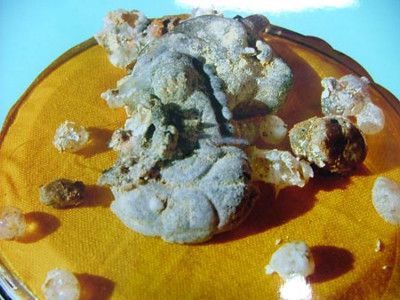 舍利子的神秘之處有哪些 高僧圓寂驚現觀音形象舍利子